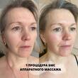 Аппаратный лифтинг массаж лица БМС  - Кабинет здоровья