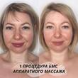 Аппаратный лифтинг массаж лица БМС  - Кабинет здоровья